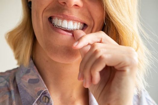Patient in South End holding Invisalign aligners
