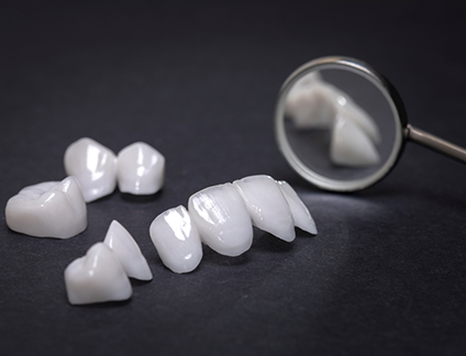 Several white veneers on a table next to a dental mirror