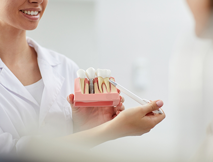 Dentist showing a model of a dental implant to a patient