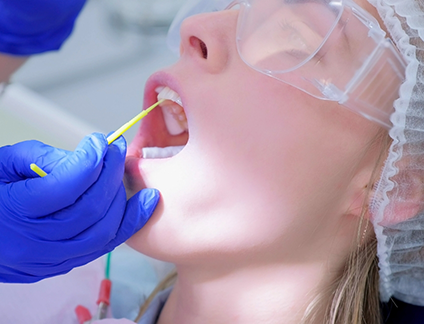 Dental patient having fluoride applied to their teeth