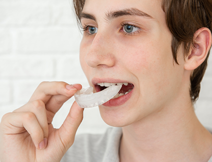 Person placing a white nightguard tray over their teeth